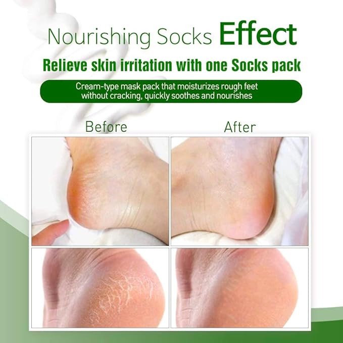 Epielle Nourishing Foot Mask 6 Pairs, Repair and Soften with Hemp & Rosemary Extract, Deep Moisturizing Socks for Dry, Cracked Feet, Self Care Gifts for Women, Spa Kit, Stocking Stuffers