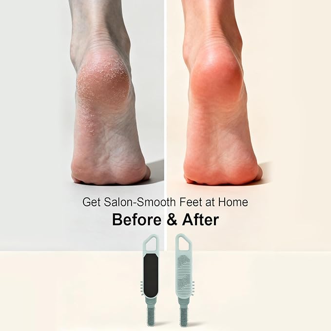 MVRPOWER Dry or Wet Foot Callus Remover - Dual-Sided Pedicure Tool with Hidden Brush & Non-Slip Grip for Home Salon Use (Green)
