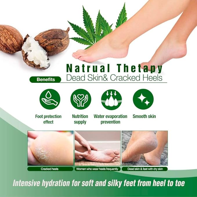 Epielle Nourishing Foot Mask 6 Pairs, Repair and Soften with Hemp & Rosemary Extract, Deep Moisturizing Socks for Dry, Cracked Feet, Self Care Gifts for Women, Spa Kit, Stocking Stuffers