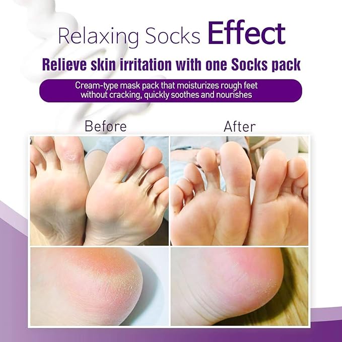 Epielle Relaxing Foot Mask 6 Pairs, Soften and Restore with Melatonin & Lavender Extract, Deep Moisturizing Socks for Dry, Cracked Feet, Self Care Gifts for Women, Spa Kit, Stocking Stuffers