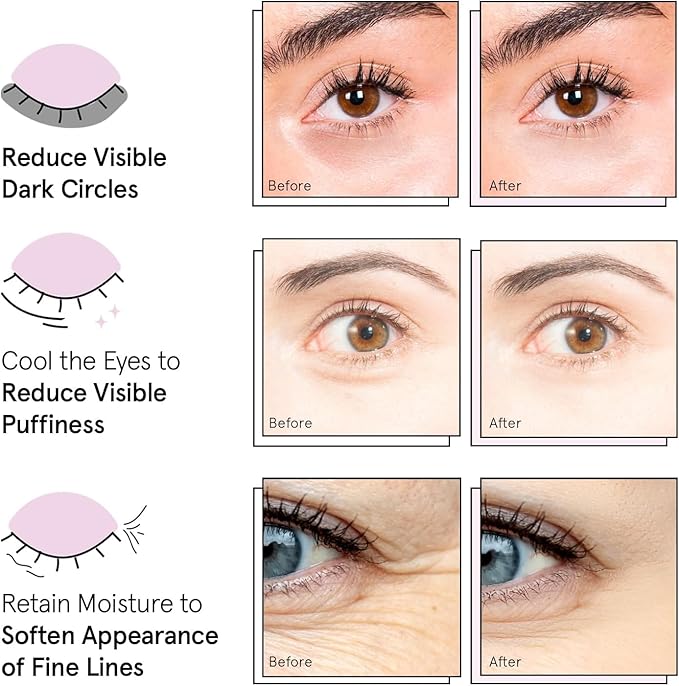 grace & stella Award Winning Under Eye Mask Reduce Dark Circles, Puffy Eyes, Wrinkles - Undereye Patches -White Elephant Gifts for Adults (Blue Eye Mask 48 Pairs)