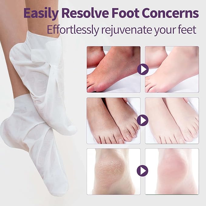 Moisturizing Foot Mask 5 Pack,Hydrating Foot Masks for Dry Cracked Feet,Moisturizing Socks Dry Skin Moisturizer for Soft and Smooth Touch Feet,Foot Care Spa Gifts for Women Men valentines day
