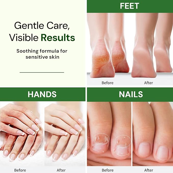 Natural Hand/Foot/Nail Cream. Made with natural and organic ingredients. Moistuizes and nourishes skin. 8oz (Tea Tree)