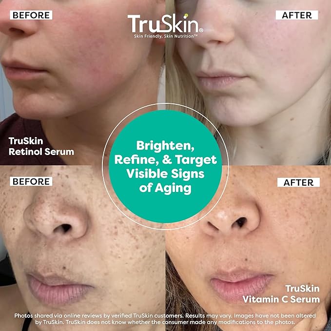 TruSkin Face Serum Duo – Vitamin C & Retinol Serum for Face – Anti-Aging Skin Care Gift Set for Women – Helps Improve Appearance of Fine Lines & Wrinkles for Smoother Looking Skin, 1 Fl Oz, 2 Bottles