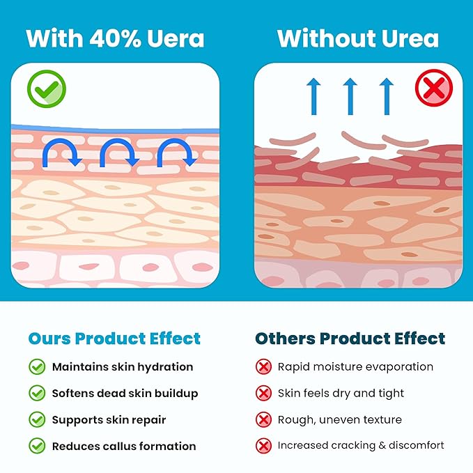 Miratiful Urea Cream 40% w 2% Salicylic Acid (4 oz) | Softens Cracked Heels & Dry Skin Urea Salicylic Acid Cream w/Tea Tree & Coconut Oil | Urea 40 Cream for Callus & Corn Treatment