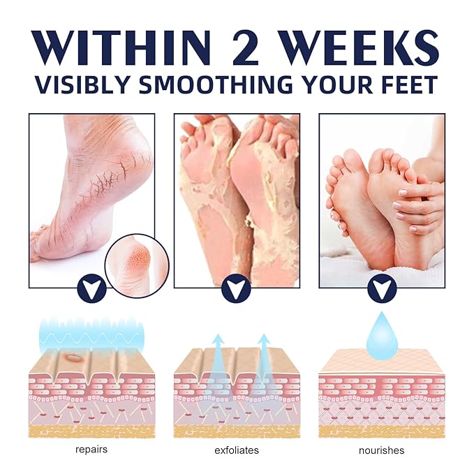AuroraHyt Ultra-Moisturizing Cream Foot and Hand Cream, 30G, for Dry Chapped Rough Peeling Skin, Cracked Heel Treatment with Beeswax and Shea Butter