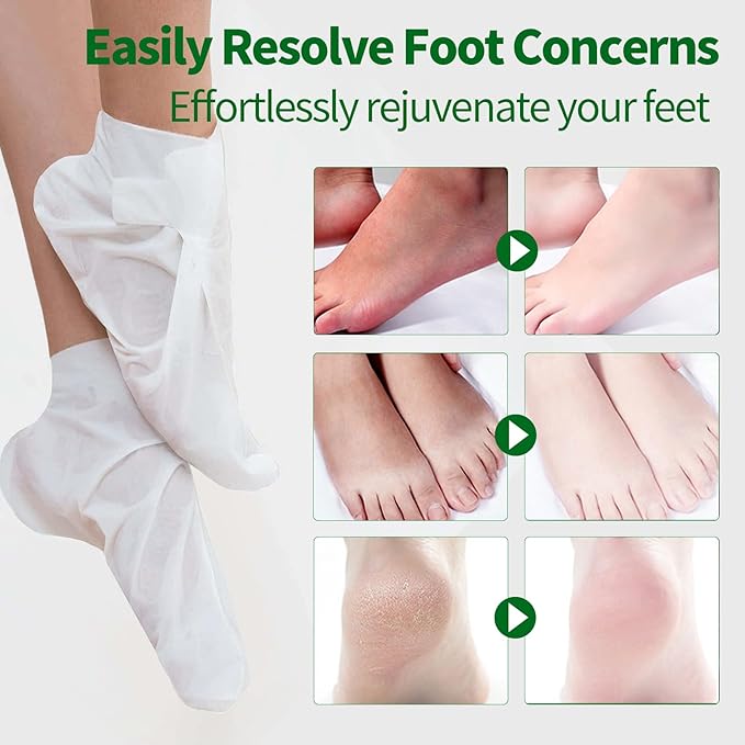 Moisturizing Foot Mask 5 Pack,Hydrating Foot Masks for Dry Cracked Feet,Moisturizing Socks Dry Skin Moisturizer for Soft and Smooth Touch Feet,Foot Care Spa Gifts for Women Men Valentines Gifts