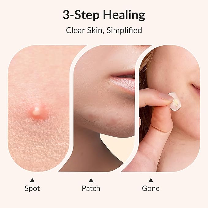 RPE Life Korean Pimple Patches – 4 Size Invisible Acne Stickers with Salicylic Acid & Hydrocolloid Miracle Patches for Pimples Zit Stickers Blemish Dots Pimple Stickers for Face - 36 Count
