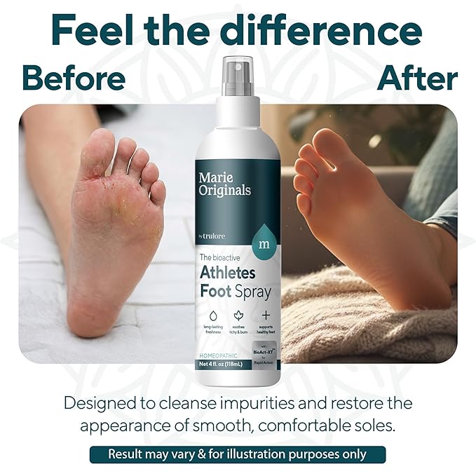 Marie Originals Homeopathic Athletes Foot Spray for Itchy Burning Skin Relief Natural Odor Control and Moisture Care Soothing Plant-Based Foot Comfort for Active Lifestyles and Daily Use 4 oz