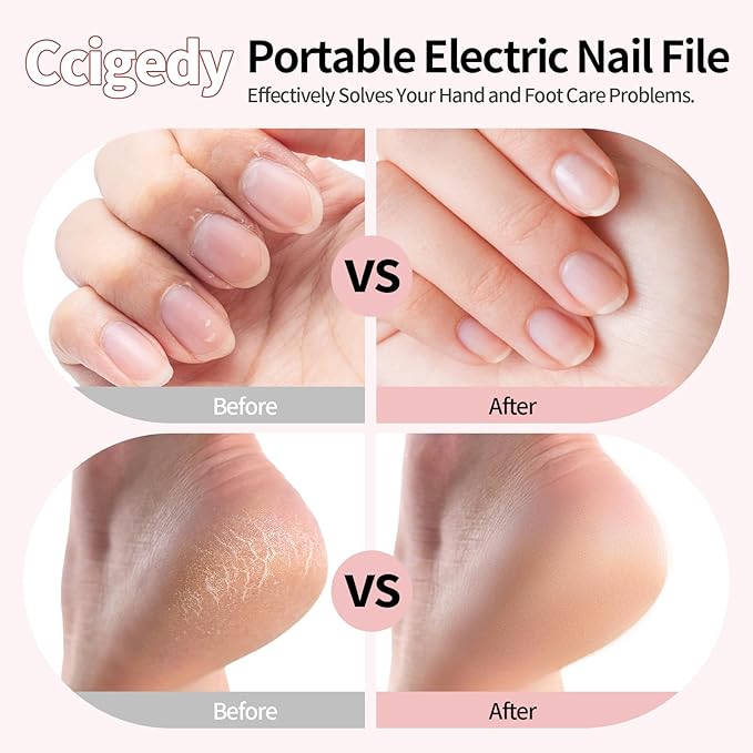 Ccigedy Professional Manicure Pedicure Electric Nail File for Thick Nails Hand Feet Care,Cordless Toenail Grinder 15 Speed,Nail Drill with LCD Screen,Ideal Valentine's Day Gift for Women/Men-Pink