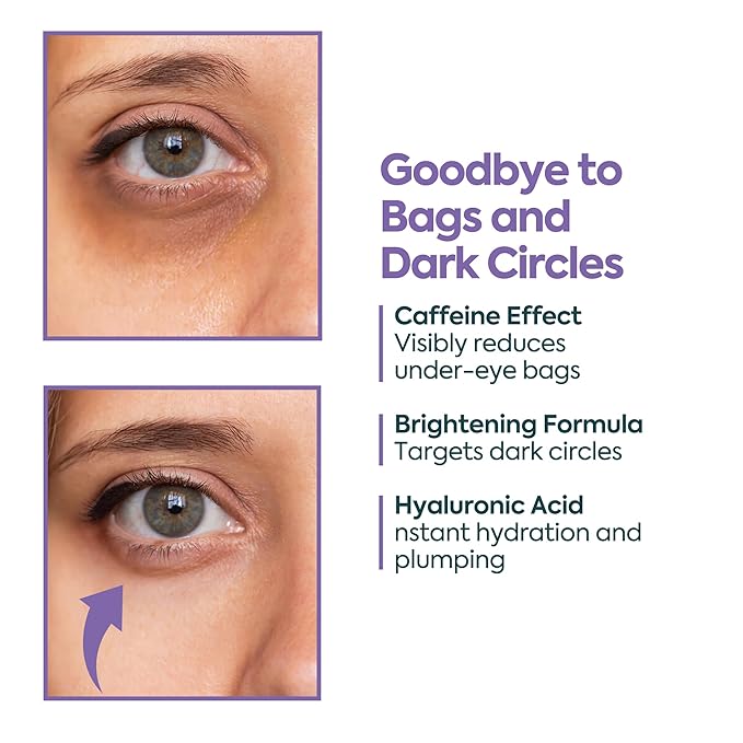 Under Eye Cream for Dark Circles and Puffiness – 5% Caffeine + 2% Hyaluronic Acid – Eye Brightening Cream for Wrinkles, Bags, Fine Lines – Korean Eye Cream for Women
