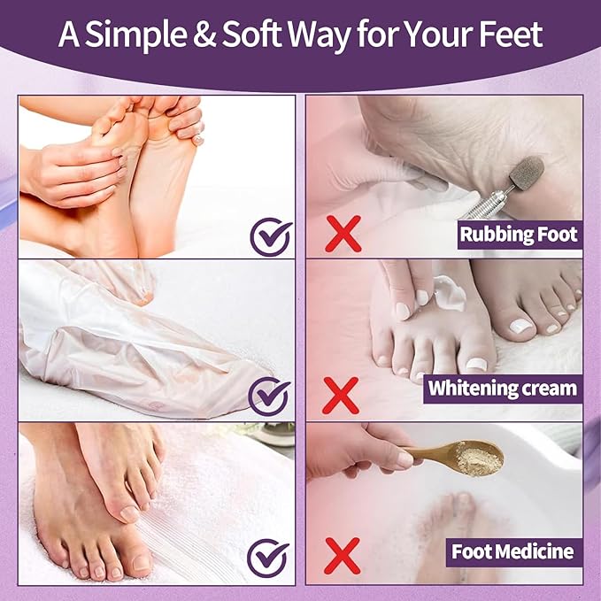 Moisturizing Foot Mask 5 Pack,Hydrating Foot Masks for Dry Cracked Feet,Moisturizing Socks Dry Skin Moisturizer for Soft and Smooth Touch Feet,Foot Care Spa Gifts for Women Men valentines day