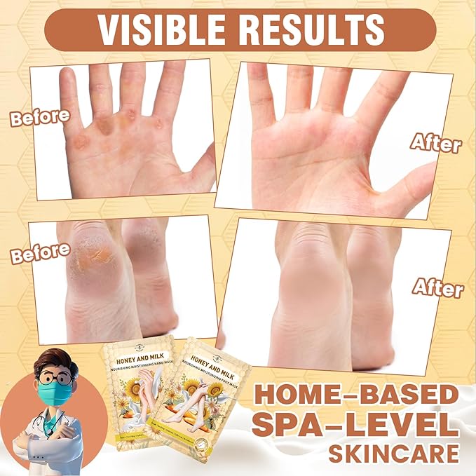Hydrating Hand and Foot Mask, 3 Foot & 3 Hand Mask, Hand and Foot Care After Pedicure, Moisturizing Socks for Dry, Cracked Heel, Foot Spa, Honey & Milk, Vitamin E
