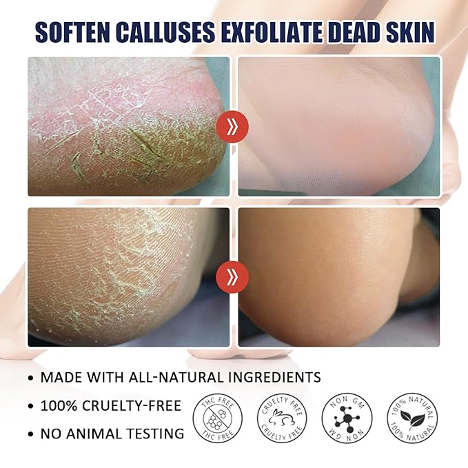 AuroraHyt Ultra-Moisturizing Cream Foot and Hand Cream, 30G, for Dry Chapped Rough Peeling Skin, Cracked Heel Treatment with Beeswax and Shea Butter