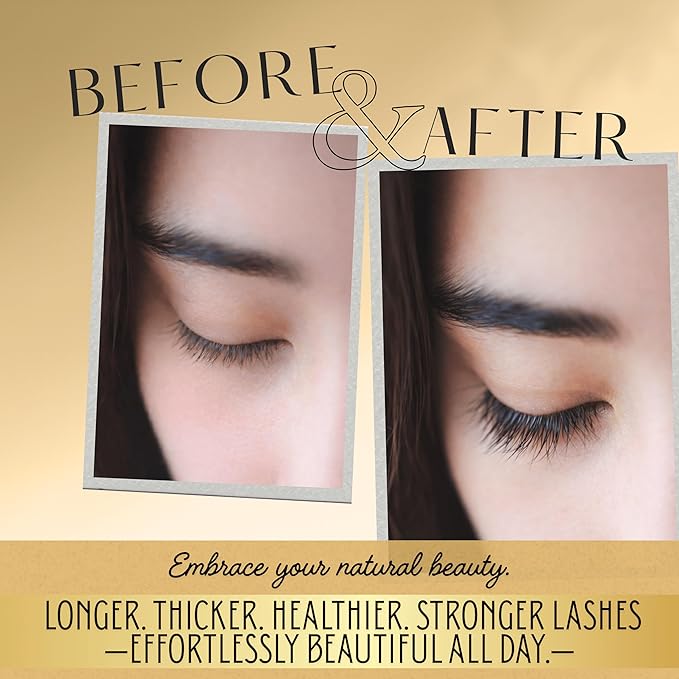 Eyelash Growth Serum - Advanced Biotin, Peptides & Botanical Extract Lash Enhancing Serum for Longer, Thicker Lashes and Brow, Visible Results in 2 Weeks - Hormone-Free, Non-Irritating Formula, 5ml