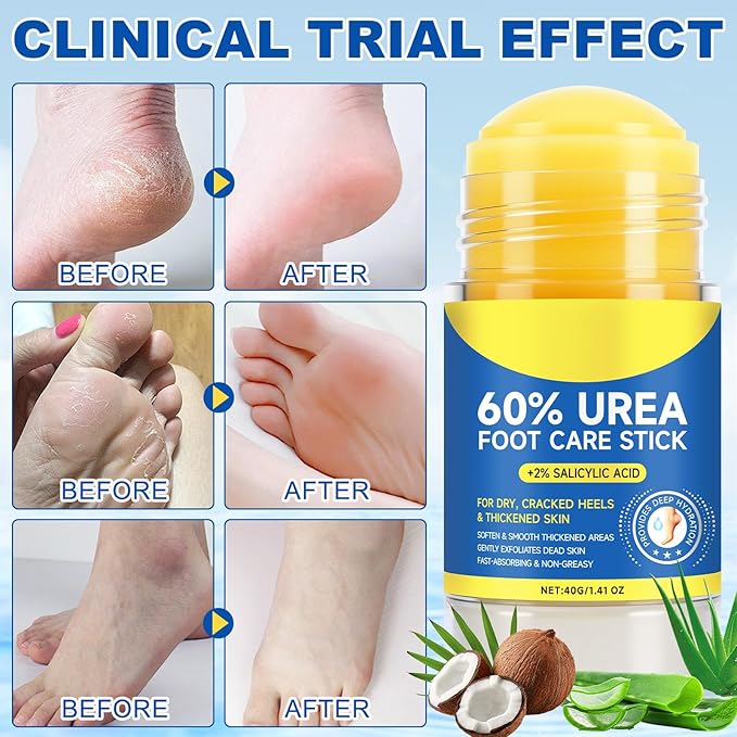 FEISIDUNWSF 60% Urea Foot Cream for Dry Cracked Heels & Feet, Hydrating Urea Cream Moisturizer for Rough, Callused Skin, Deep Repair & Softening Foot Balm, Fast Absorbing, Exfoliating Formula, 1.4oz