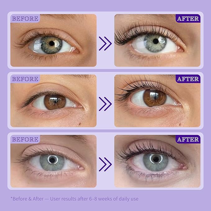 ICIKOL Lash Serum for Eyelash Growth, Advanced Peptide & Biotin Formula for Thicker, Fuller, Longer Lashes in 4-6 Weeks, Prostaglandin-Free Lash Enhancer for Women 35+ (Eyelash Serum - 16mL)
