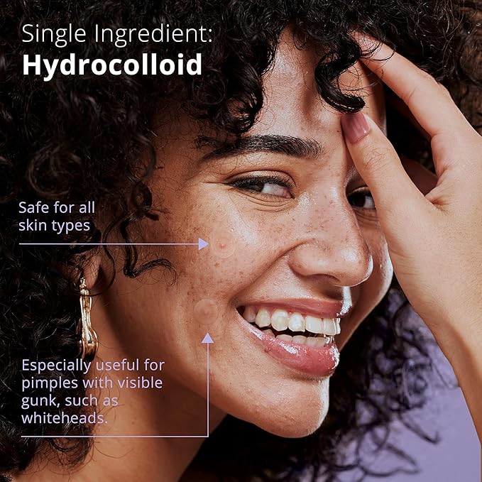 SimpleField Pimple Patches for Face (96 Count). Invisible Hydrocolloid Acne Patch for Blemishes, Zits, and Breakouts. Easy-to-Use Spot Cover for Day & Night, One Size - Medium (12mm)