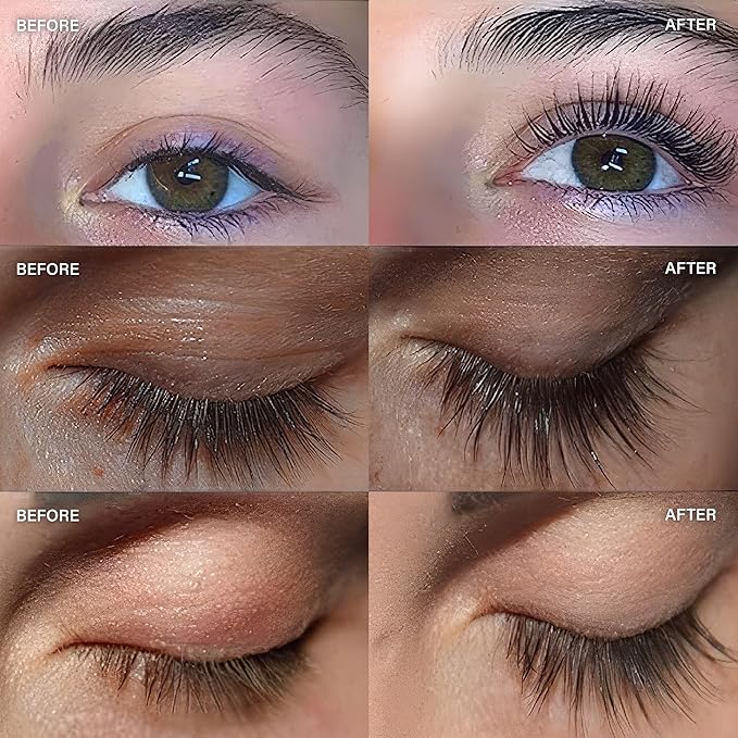 ForChics Lash & Brow Growth Bundle - Complete Eye Makeover Kit - Hormone-Free, Prostaglandin-Free Duo for Longer Lashes & Fuller Brows in 2 Weeks - Natural, Vegan [2x 3mL]